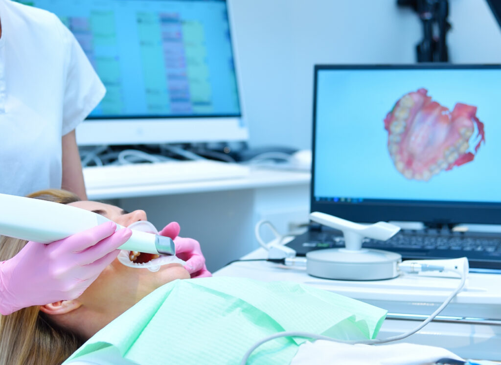 intraoral scan