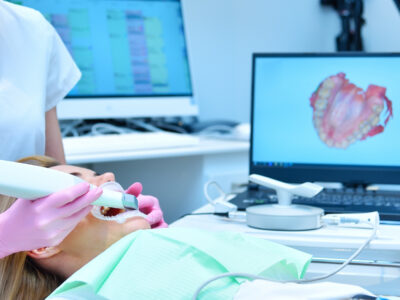 intraoral scan