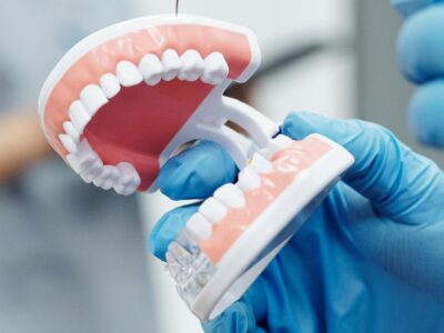 Gloved hands holding a dental model of upper and lower teeth